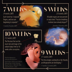 Jewelry, Lapel Pin, Precious Feet, Silver-Colored, NEW Milestones Fetal Development Card